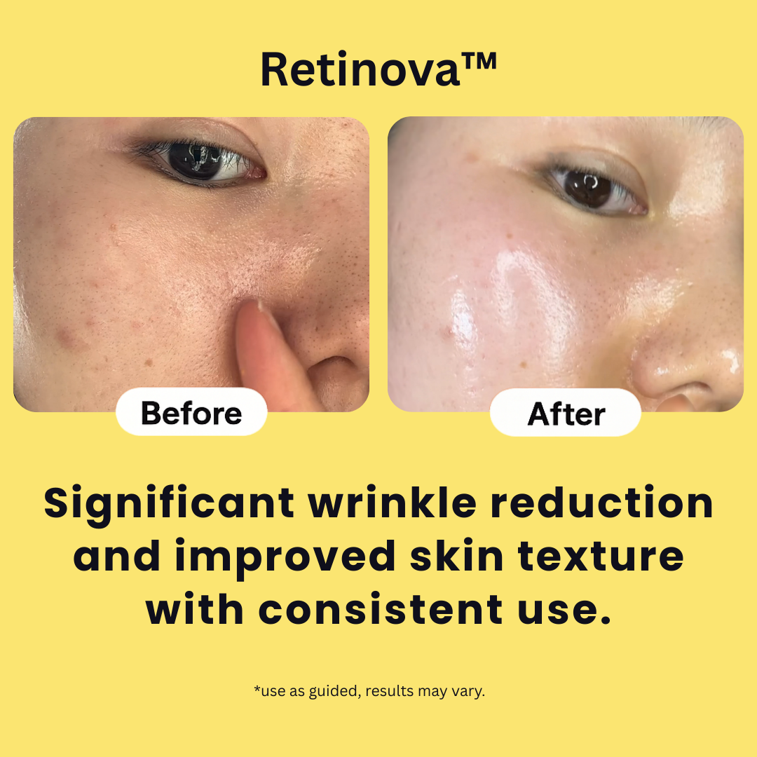 Retinova™ Retinal Shot