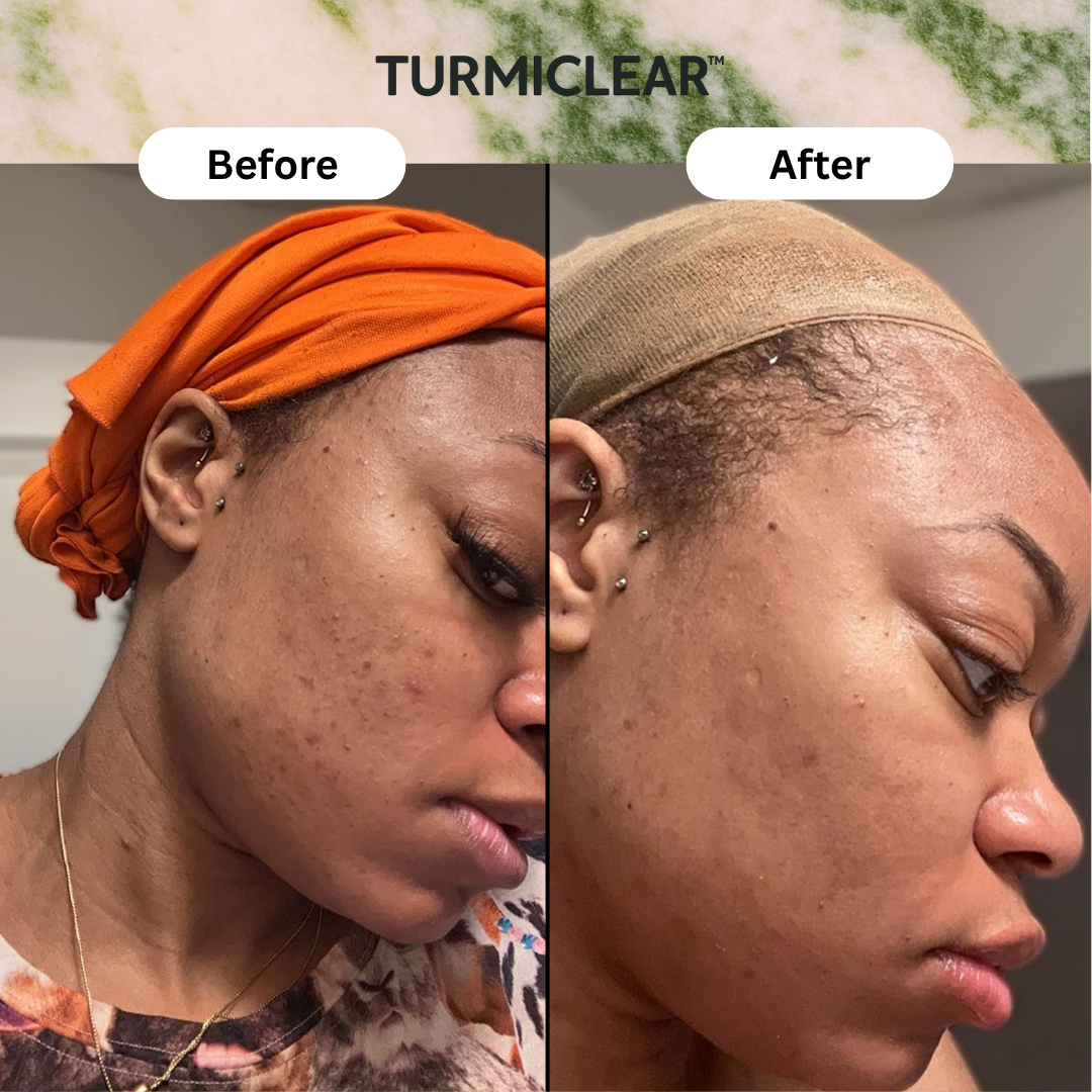 Turmiclear™ Brightening Bar