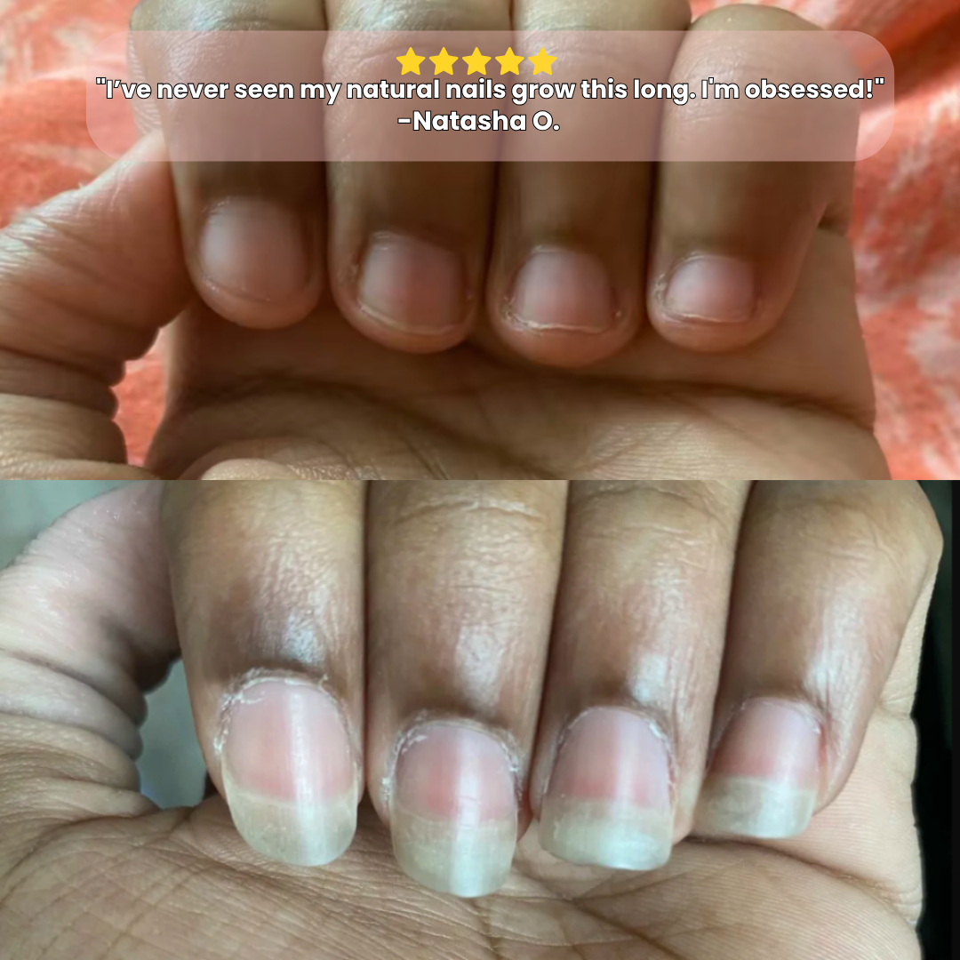 NailLuxe™ Nail Growth Oil