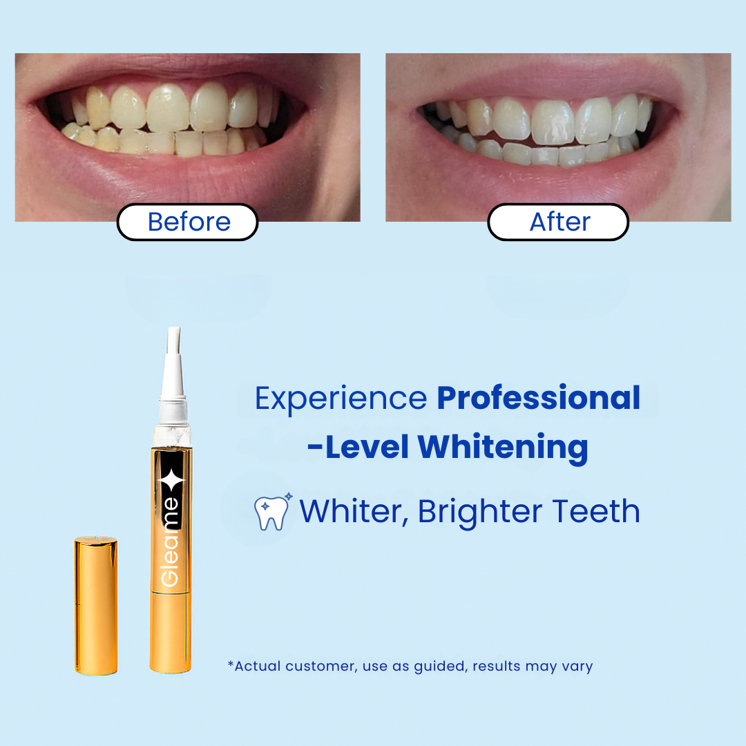 Gleame™ Teeth Whitening Pen